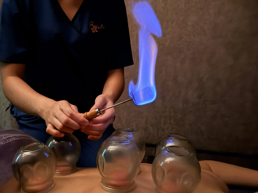 Body cupping service at Aroma Wellness & Spa Sandakan
